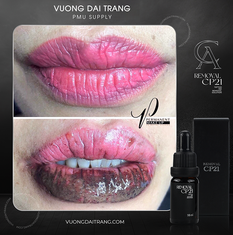 dung dịch hút mực môi