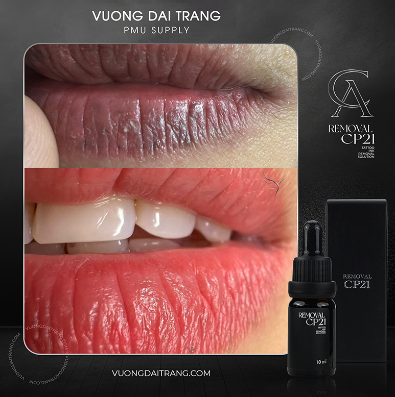 phục hồi nền môi sau xử lý